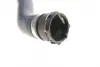 Патрубок радіатора BMW X5 (E53) 3.0i 00-06 IMPERGOM 222249 (фото 3)