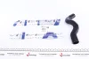 Патрубок радіатора Renault Clio II/Kangoo 1.4/1.6 97-08 IMPERGOM 223174 (фото 1)