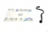 Патрубок радіатора BMW X5 (E53) 4.4i/4.6is 00-03 IMPERGOM 224682 (фото 1)