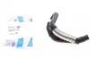 Патрубок системи охолодження Skoda Octavia III/VW Golf V 1.9TDI/2.0TDI 03-11 (к-кт в зборі) IMPERGOM 229008 (фото 1)