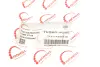 Патрубок інтеркулера VW Caddy 1.9/2.0TDI 04-15 ROTWEISS RWS2728 (фото 5)