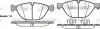 Колодки гальмівні (передні) BMW X5 (E70/F15/F85) 06-/X6 (E71/E72/F16/F86) 08- WOKING P13983.00 (фото 1)